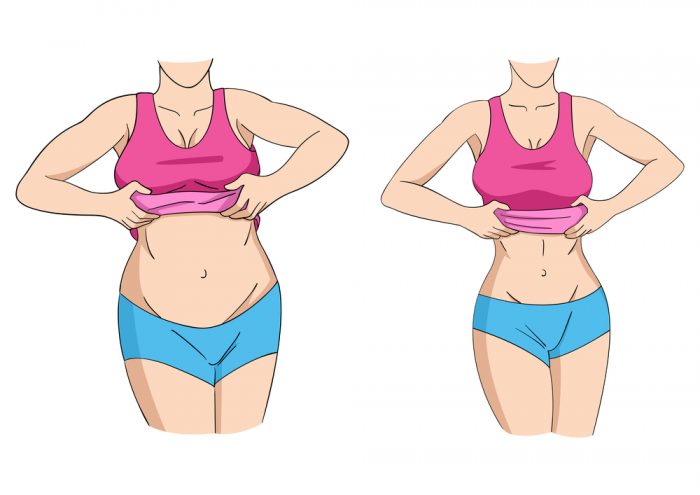 Belly Weight-Loss Transformations